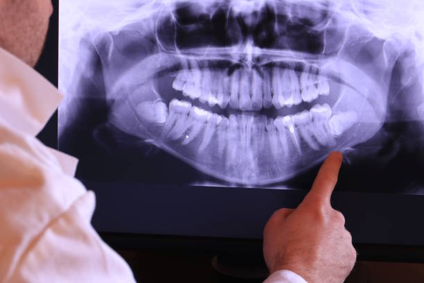 Best Urgent Tooth Repair  in Sloatsburg, NY